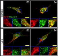 Images of human neurons, generated by directed conversion of human skin fibroblasts, and treated with a compound aimed at suppressing Alzheimer's changes.